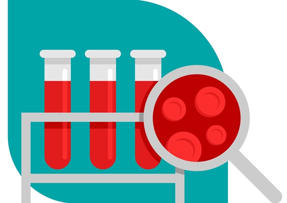 Image: The sensitive liquid biopsy test that uses RNA instead of DNA for detecting cancer (Courtesy of Adobe Stock)