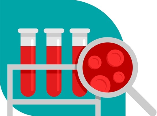 Image: The sensitive liquid biopsy test that uses RNA instead of DNA for detecting cancer (Courtesy of Adobe Stock)