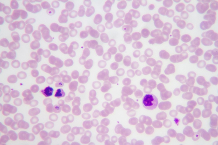 Image: Proteins in the blood can reveal the severity of malaria (Photo courtesy of Adobe Stock)