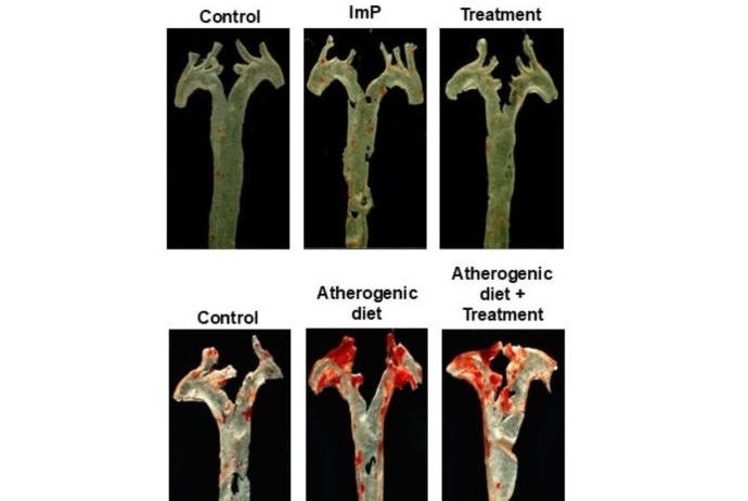 Image: Researchers have identified a metabolite produced by gut bacteria as a driver of atherosclerosis (Photo courtesy of CNIC)