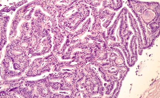 Image: The AI-powered framework identifies critical transitions and classifies thyroid cancer subtypes (Photo courtesy of Shutterstock)