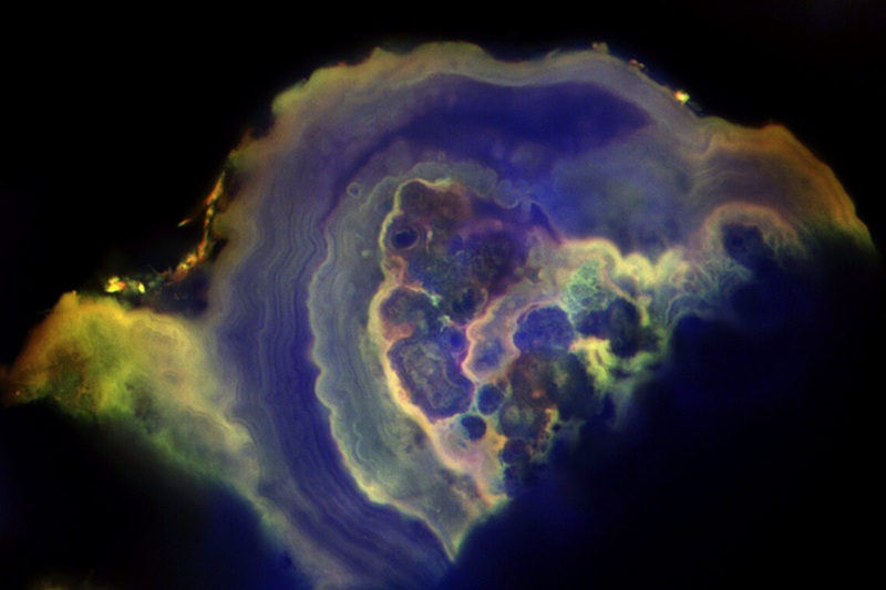Image: Calcium phosphate nodules clumped together and encrusted by thick layers of more calcium phosphate (Photo courtesy of Mayandi Sivaguru)