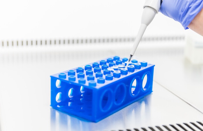 Image: A diagnostic test can distinguish patients with head and neck squamous cell carcinoma who can be cured with surgery alone (Photo courtesy of University of Turku)