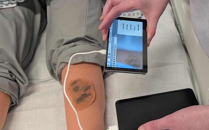 Image: The new device uses AI to analyze images of skin lesions and flag potential risks for further medical review (Photo courtesy of Heriot-Watt University)