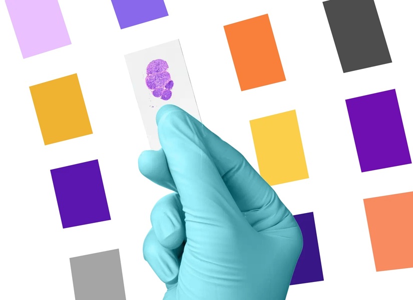 Image: The OncoExTra assay uses whole-exome, whole-transcriptome sequencing across ~20,000 genes to fill in the blanks left by fixed-panel tests (Photo courtesy of Exact Sciences)
