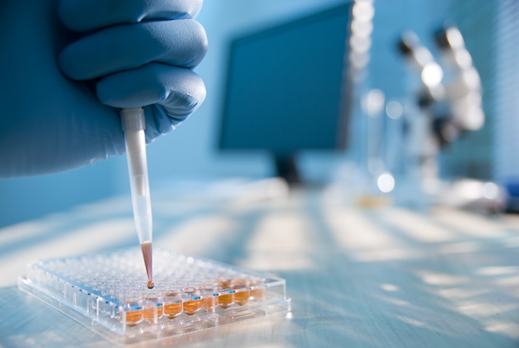 Image: The cell-based tests bring artificial intelligence to transplant outcome care (Photo courtesy of iStock)