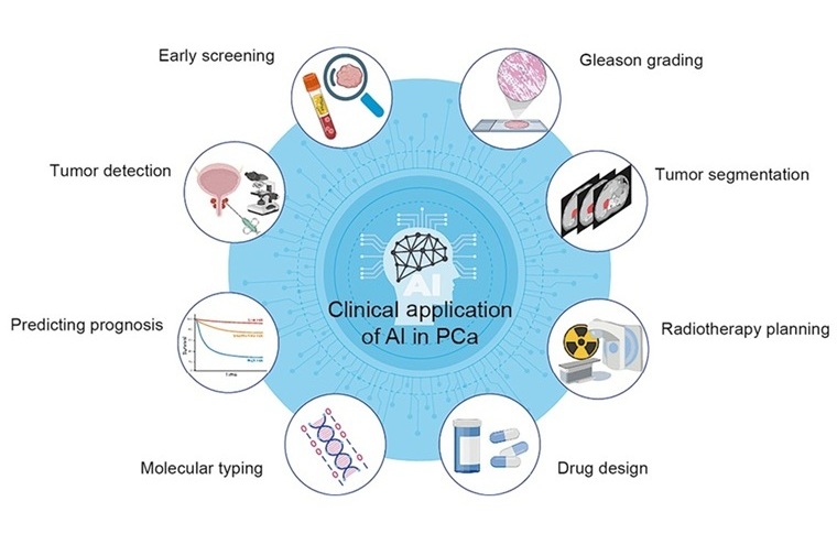 image: The study highlights the role of artificial intelligence in prostate cancer management (Chinese Medical Journal 138(15):1769-1782, 2025)