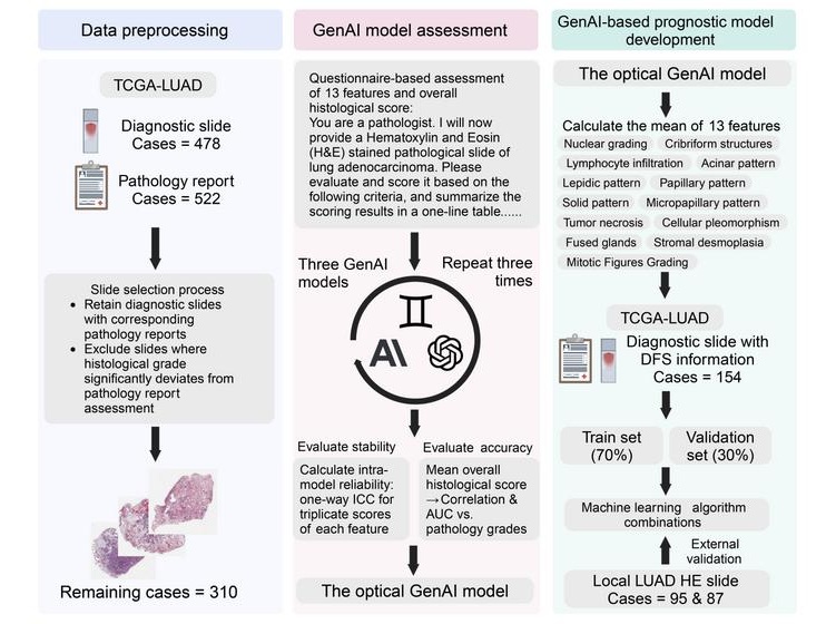 Image: Genai-based pathological assessment workflow for lung adenocarcinoma (Shen J. et al., Int J Surg 111(7): 4252–4262; 2025)