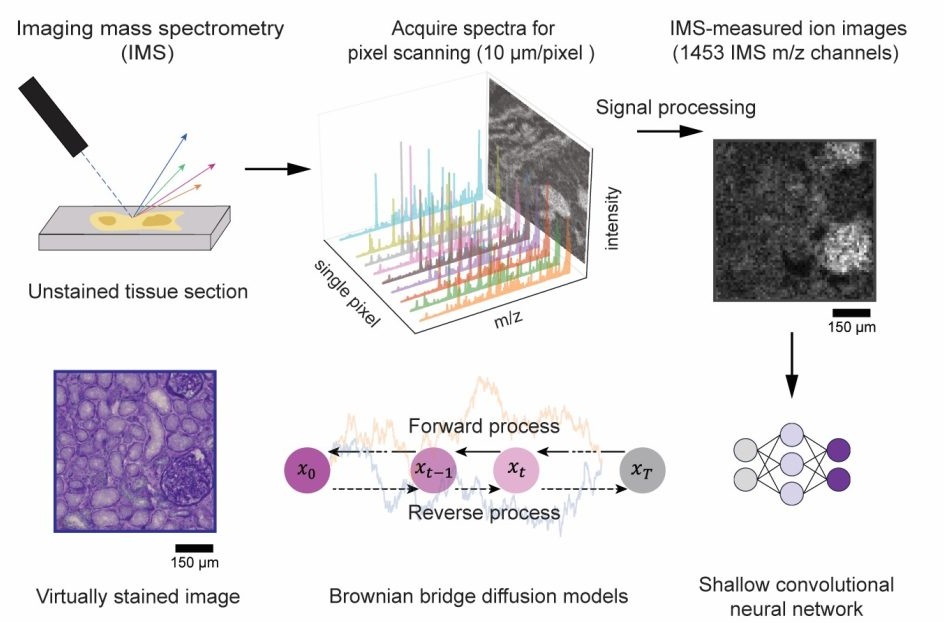 Image: Virtual staining of label-free tissue in imaging mass spectrometry (Photo courtesy of Ozcan Lab/UCLA)