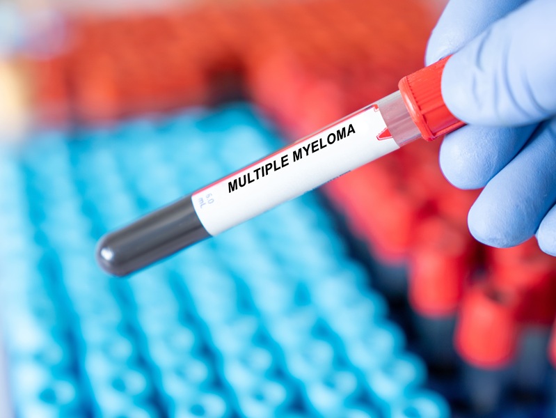 Image: The blood-based technology could replace or complement invasive biopsies (Photo courtesy of Adobe Stock)