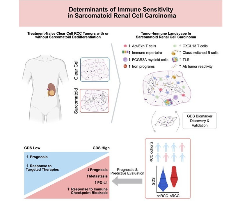 Image: Insights into sarcomatoid renal cell carcinoma point to broader use of common immunotherapies (Photo courtesy of Salgia NJ et al., Cancer Cell, 2025)