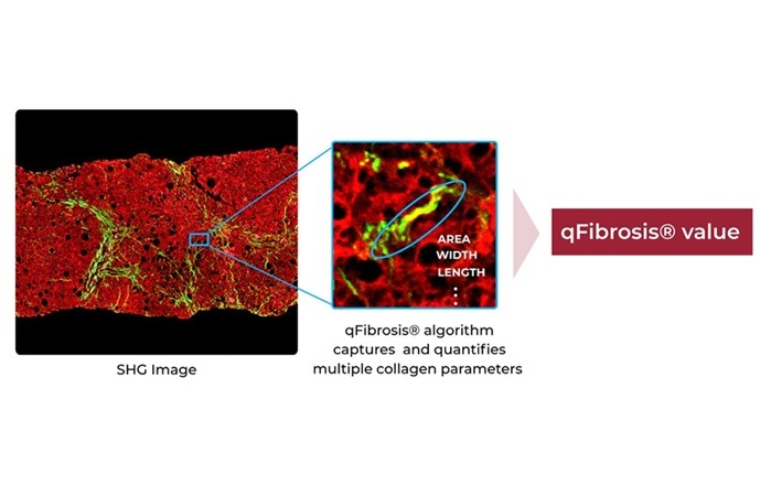 Image: Quantifying multiple collagen parameters with qFibrosis (Photo courtesy of HistoIndex)