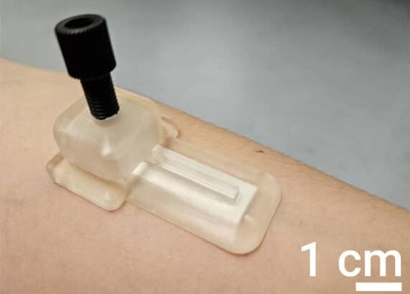 Image: The microneedle patch can collect biomarker samples in as little as 15 minutes (Photo courtesy of Michael Daniele/NC State University)