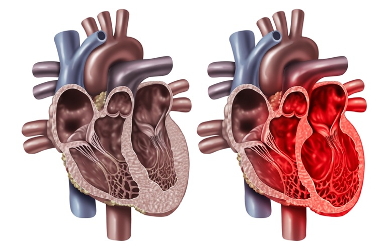 Image: The solution can improve ICU clinical pathways for patients with possible Takotsubo syndrome (Photo courtesy of Shutterstock)