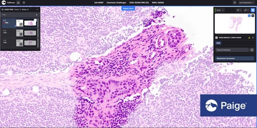 Image: Paige’s proprietary dataset comprises almost 7 million digitized pathology slides that are clinically annotated (Photo courtesy of Paige)