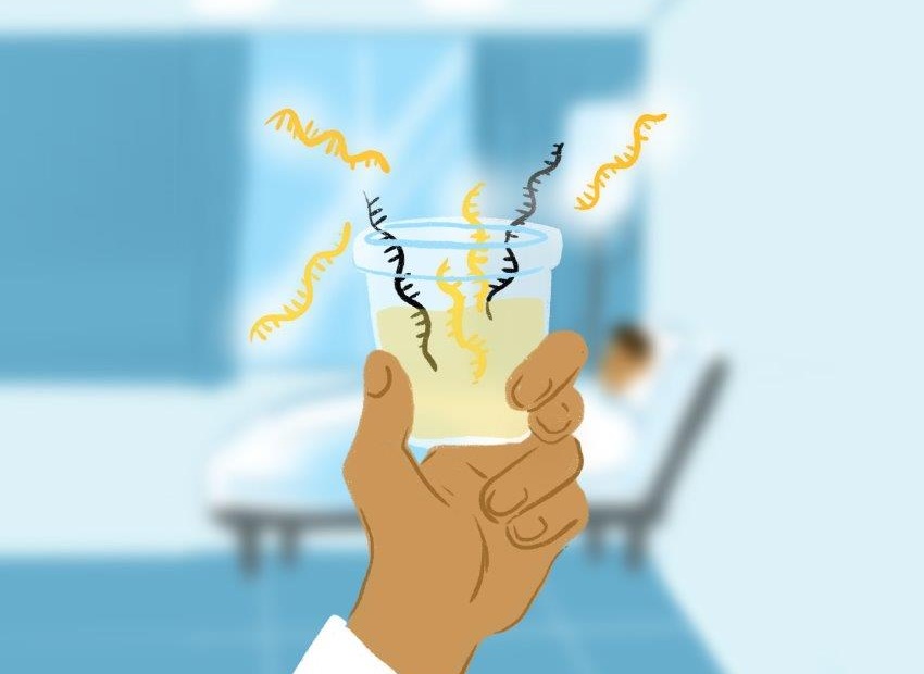 Image: Biomarkers in urine can accurately detect prostate cancer (Photo courtesy of Ella Maru Studio)