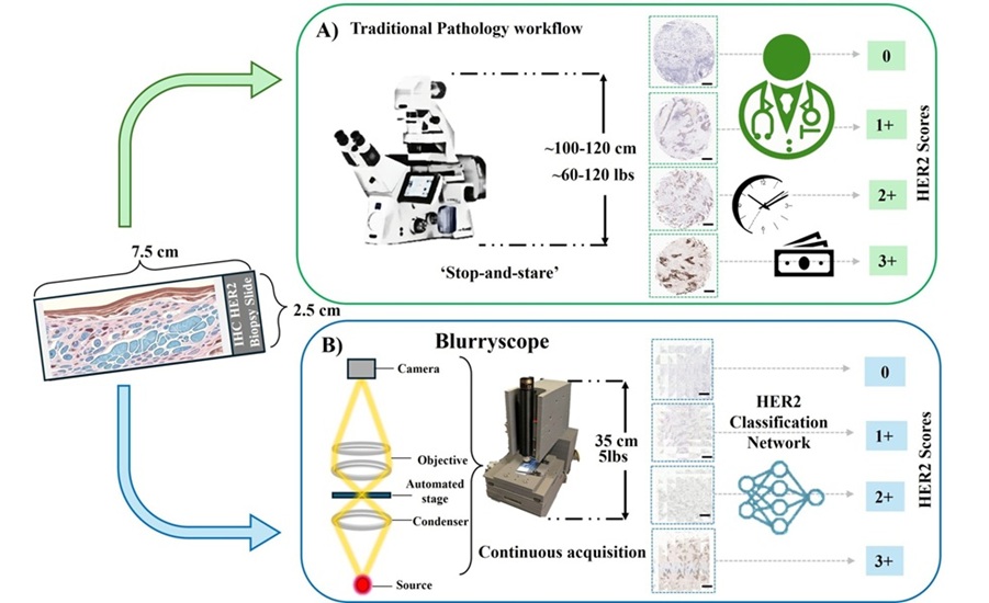 Image: BlurryScope enables compact, cost-effective scanning microscopy for HER2 scoring using deep learning on blurry images (Photo courtesy of Ozcan Lab at UCLA)