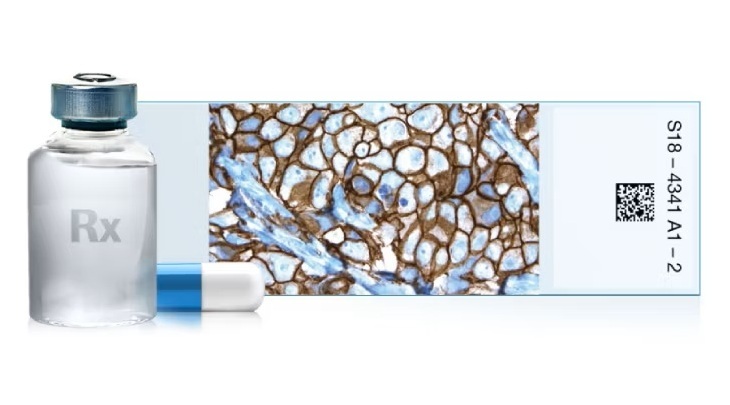 Image: The VENTANA HER2 (4B5) test is now CE-IVDR approved (Photo courtesy of Roche)