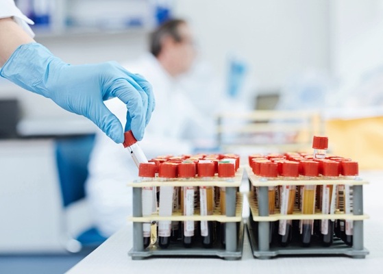 Image: The blood-based method could support early disease detection and risk stratification (Photo courtesy of Shutterstock)