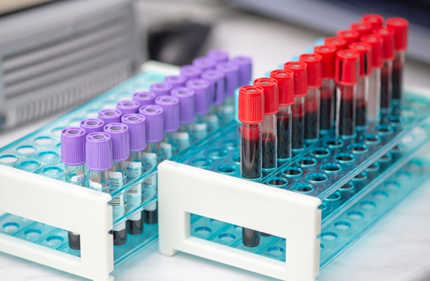 Image: The blood-based test opens a new path for HPV-associated head and neck cancer screening (Photo courtesy of Adobe Stock)