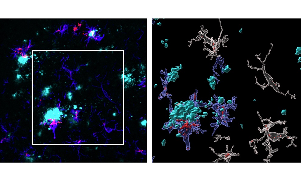 Image: Left is the original cell image and right is same cell image zoomed in and rendered in the special imaging software (Photo courtesy of FIU)