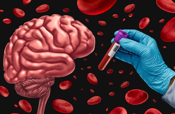 Image: The study has linked blood proteins to Alzheimer’s disease and memory loss (Photo courtesy of Shutterstock)
