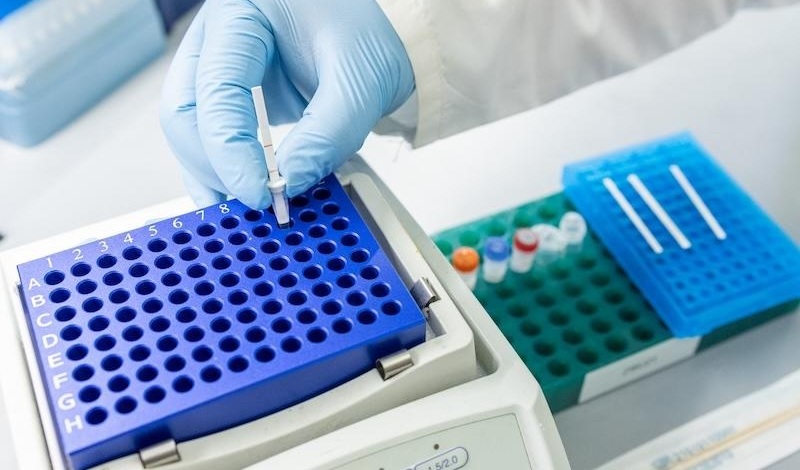 Image: The genetic-based method enables accurate detection of TB from tongue swabs (Photo courtesy of Kenny Lass/Tulane University)