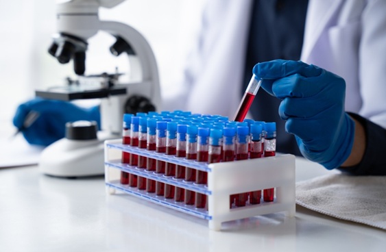 Image: Routine blood tests could provide early warning signs about spinal cord injury patient outcomes (Photo courtesy of Shutterstock)