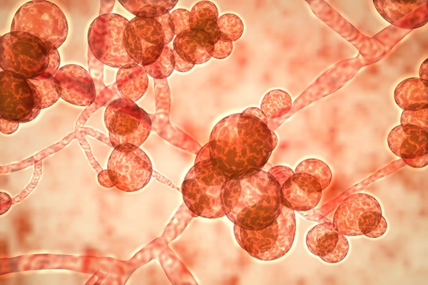 Image: Sugar fingerprints open new possibilities for faster and more reliable diagnosis of fungal infections (Photo courtesy of 123RF)