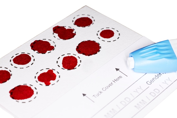 Image: PCR-based test performed on dried blood spots can reliably detect congenital CMV at birth (Photo courtesy of Adobe Stock)
