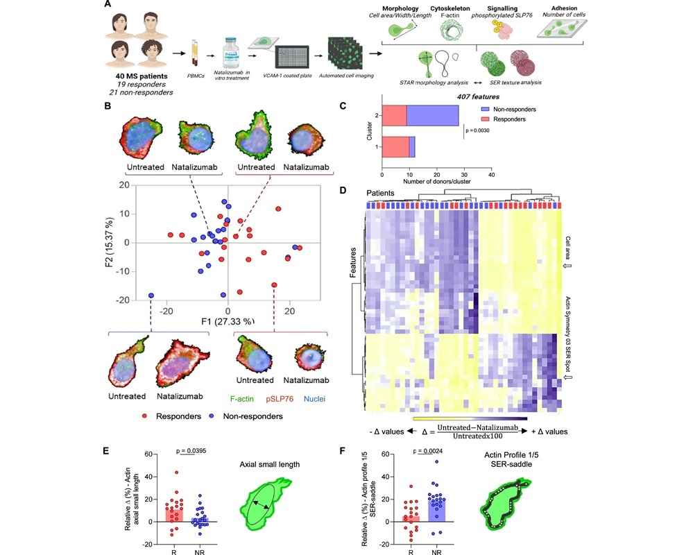 Image: Automated cell imaging discriminates CD8+ T cells according to natalizumab treatment outcome in MS patients (B Chaves et al., Nat Commun 16, 5533 (2025). DOI: 10.1038/s41467-025-60224-3)