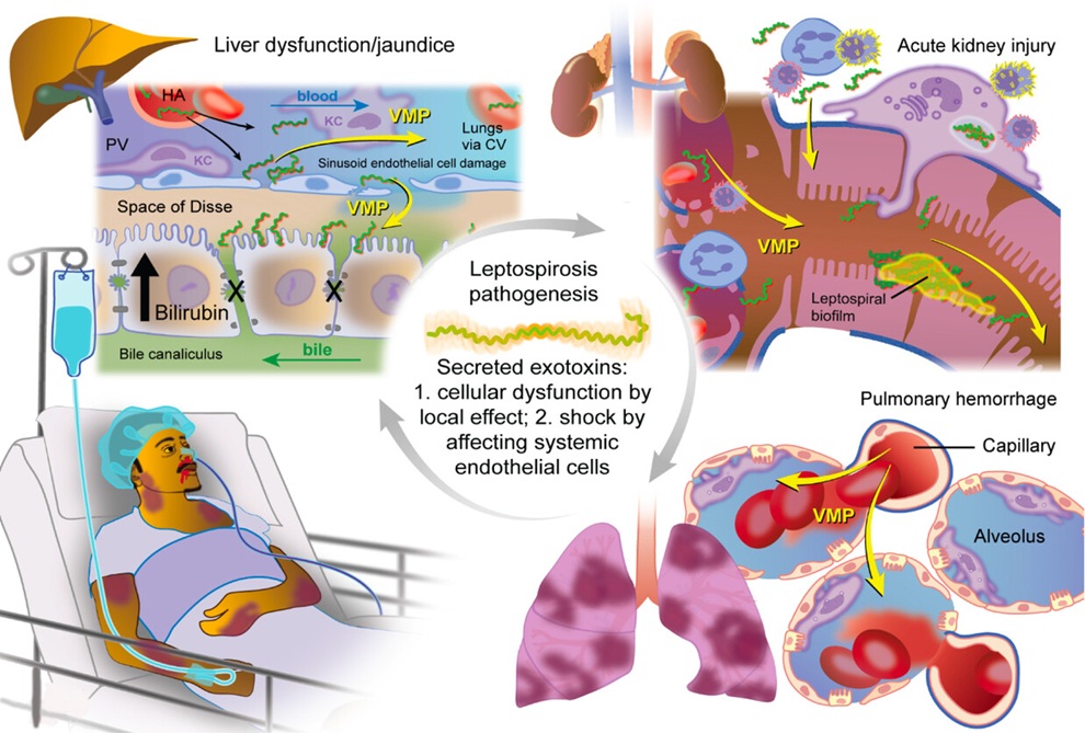 Image: Hypothetical schematic representation of virulence-modifying (VM) proteins proteins in mediated leptospirosis pathogenesis (Chaurasia R. et al., Microbiology Spectrum (2025). doi.org/10.1128/spectrum.00018-25)