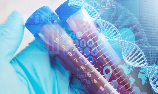 Image: Laguna Diagnostics has been awarded its second US patent for rapid blood tests to differentiate schizophrenia and bipolar disorder (Photo courtesy of Shutterstock)