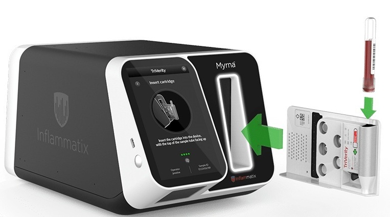 Image: The TriVerity IVD test includes the TriVerity cartridge and the Myrna instrument (Photo courtesy of Inflammatix)