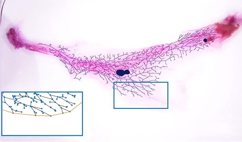 Image: The MaGNet platform zooming in on one section of a mouse mammary gland’s ductal tree (Photo courtesy of Dos Santos lab/CSHL)