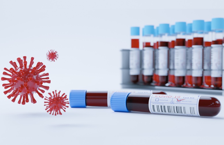 Image: The potential biomarker could identify existing tissue damage, long-term immune activation and complications following COVID-19 (Photo courtesy of 123RF)