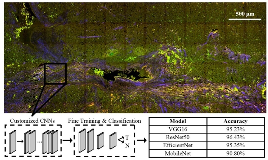 Image: Label-free multiphoton microscopy and deep learning can be used in combination to classify pancreatic neuroendocrine neoplasms with high accuracy (Photo courtesy of N. Daigle/University of Arizona)