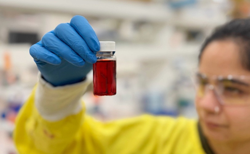 Image: Researcher Sanskruti Lakhotia holds a bottle of the nanoparticle formula being used to develop Nexsen\'s kidney diagnostic tests (Photo courtesy of RMIT University)