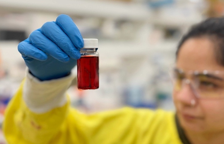 Image: Researcher Sanskruti Lakhotia holds a bottle of the nanoparticle formula being used to develop Nexsen’s kidney diagnostic tests (Photo courtesy of RMIT University)