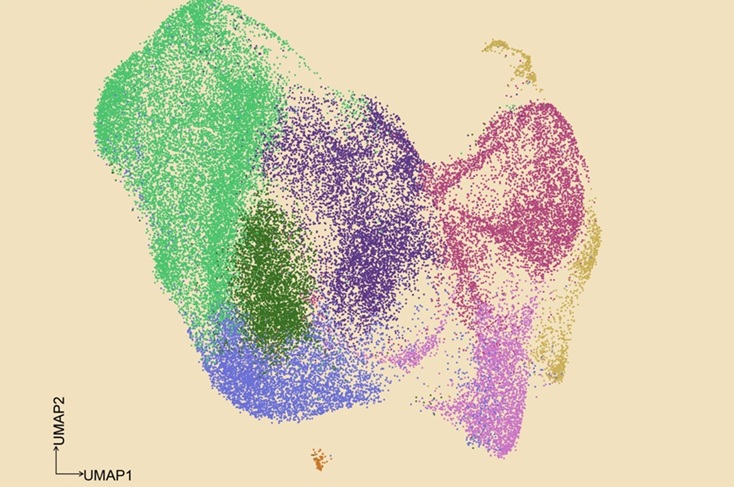 Image: A UMAP graphical depiction of 45,963 cancer cells from patients whose chronic lymphocytic leukemia has transformed into a more aggressive type (Photo courtesy of the Nam lab)