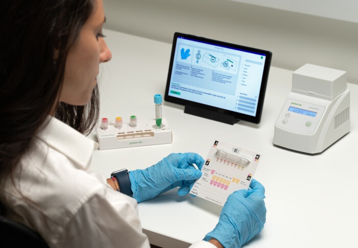 Image: A researcher demonstrates a portable POC diagnostic device for detecting asymptomatic malaria cases (Photo courtesy of Imperial College London)