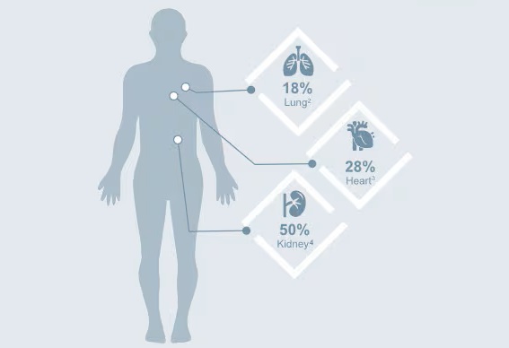 Image: When assessing the same organ biopsy sample, only a fraction of pathologists will agree on a TCMR diagnosis (Photo courtesy of Thermo Fisher)