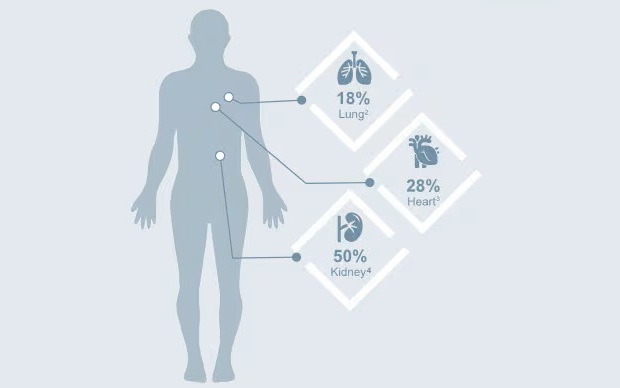 Image: When assessing the same lung biopsy sample, research shows that only 18% of pathologists will agree on a TCMR diagnosis (Photo courtesy of Thermo Fisher)