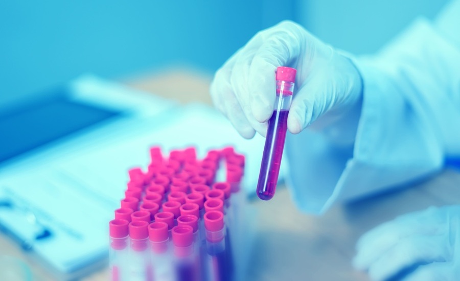 Image: The new blood test shows promise in detecting ALS early (Photo courtesy of 123RF) Image: The new blood test shows promise in detecting ALS early (Photo courtesy of 123RF)