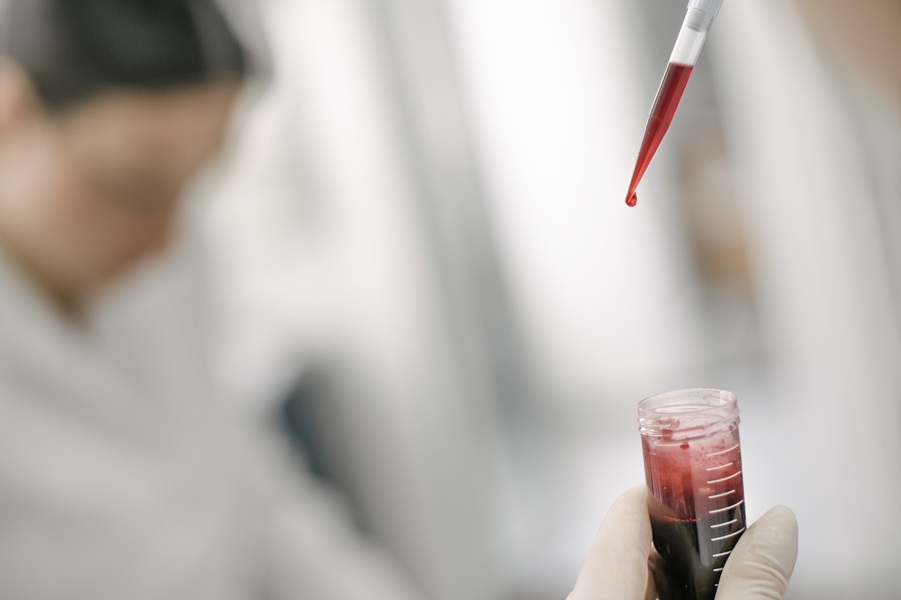 Image: The AI-powered blood test can predict suicide risk in bipolar patients with 95% accuracy (Photo courtesy of 123RF) Image: The AI-powered blood test can predict suicide risk in bipolar patients with 95% accuracy (Photo courtesy of 123RF)