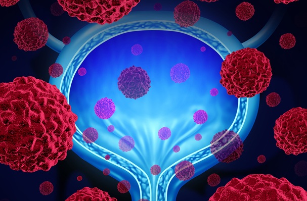 Image: The study shows that periodic ctDNA screening after surgery can help guide a decision to begin adjuvant immunotherapy (Photo courtesy of Adobe Stock) Image: The study shows that periodic ctDNA screening after surgery can help guide a decision to begin adjuvant immunotherapy (Photo courtesy of Adobe Stock)
