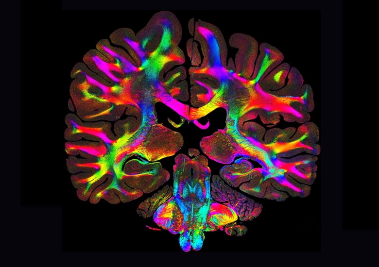 Image: Using the approach, the team visualized intricate neuronal networks across full human brain sections (Photo courtesy of Marios Georgiadis)