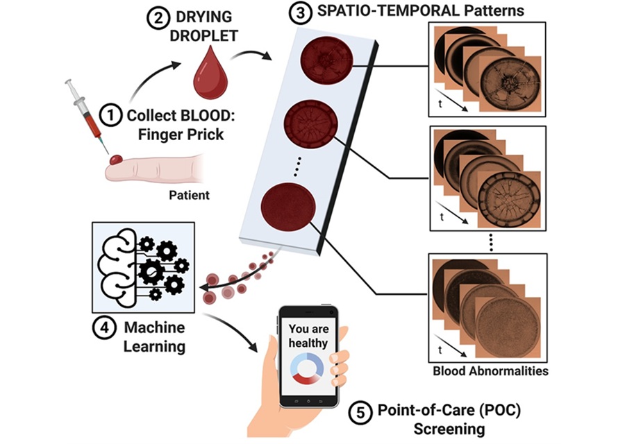 Image: The innovative diagnostic technology analyzes the full drying process of a blood droplet using machine learning (Photo courtesy of Anusuya Pal/The University of Tokyo)