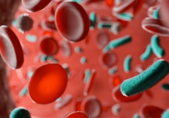Image: The rapid sepsis test detected nearly three times more bloodstream infections than conventional blood cultures (Photo courtesy of Adobe Stock)