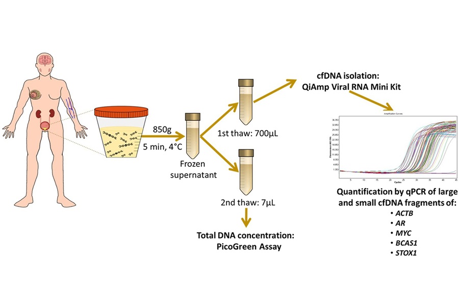 Image: Analysis of specific patterns of cfDNA fragmentation in urine samples can diagnose and stage bladder cancer (Herranz et al., The Journal of Molecular Diagnostics, DOI: 10.1016/j.jmoldx.2025.08.010)